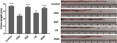 Lactobacillus fermentum ZS40 Ameliorates Inflammation in Mice With Ulcerative Colitis Induced by Dextran Sulfate Sodium